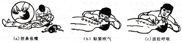 口對(duì)口吹氣人工呼吸法