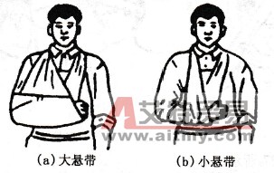上肢創(chuàng)傷包扎法