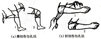 膝(肘)創(chuàng)傷包扎法